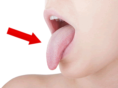 アレルゲン舌下免疫療法を行っています